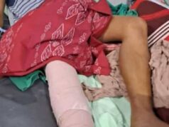 Lagi-lagi Lokasi Tambang Tatelu Menelan Korban Jiwa. Satu Meninggal, Satunya lagi Patah Kaki